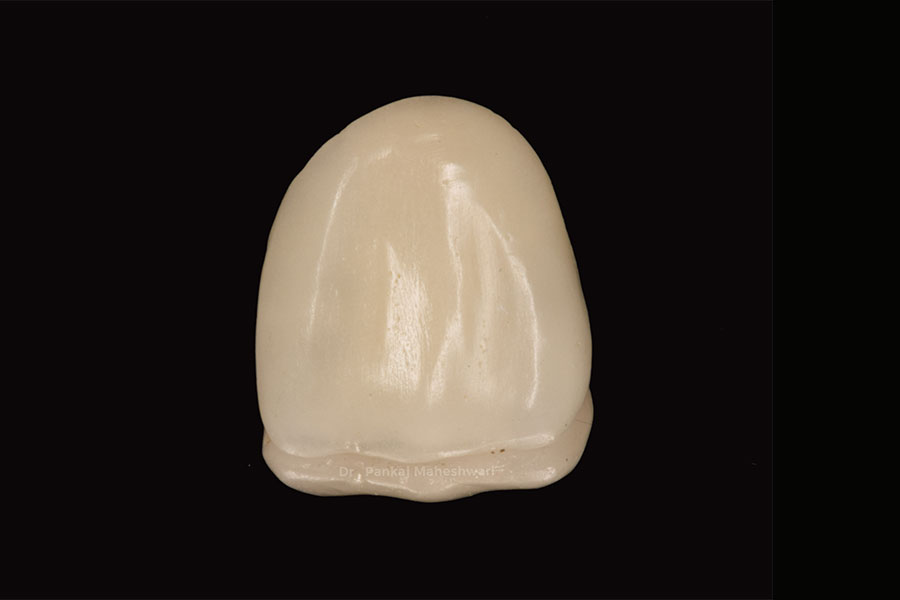 Dental Cap